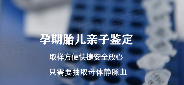 镇江孕期亲子鉴定流程, 镇江孕期亲子鉴定流程,