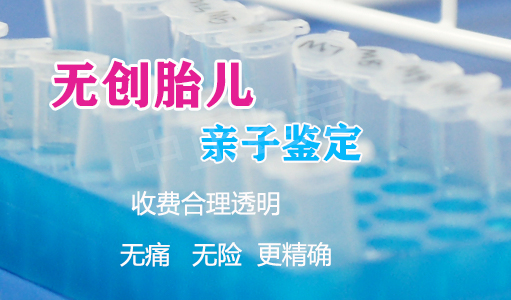 镇江胎儿怎么做DNA亲子鉴定,镇江无创怀孕亲子鉴定收费明细