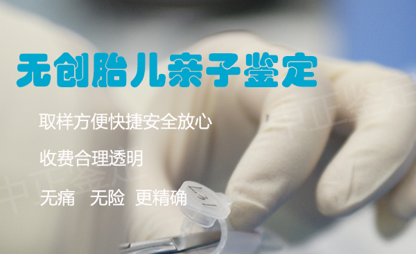 镇江孕期亲子鉴定机构出结果要多久,镇江孕期亲子鉴定哪里可以办理 镇江孕期亲子鉴定机构出结果要多久,镇江孕期亲子鉴定哪里可以办理